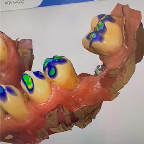 𝐓𝐫𝐚𝐧𝐬𝐟𝐨𝐫𝐦𝐞 𝐬𝐞𝐮 𝐬𝐨𝐫𝐫𝐢𝐬𝐨 𝐜𝐨𝐦 𝐚 𝐭𝐞𝐜𝐧𝐨𝐥𝐨𝐠𝐢𝐚 𝟑𝐃!  Com o scanner 3D, os seus tratamentos dentários são rápidos, precisos e muito mais confortáveis. Acabaram-se os moldes desconfortáveis - agora pode ver o futuro do seu sorriso antes mesmo de começar! Marque a sua consulta e experimente a inovação da medicina dentária digital. ✨